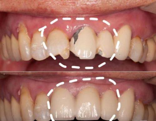 东莞芽豆口腔地址电话营业时间