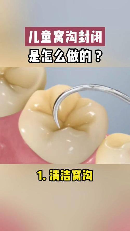 东莞芽豆口腔是正规医院吗？