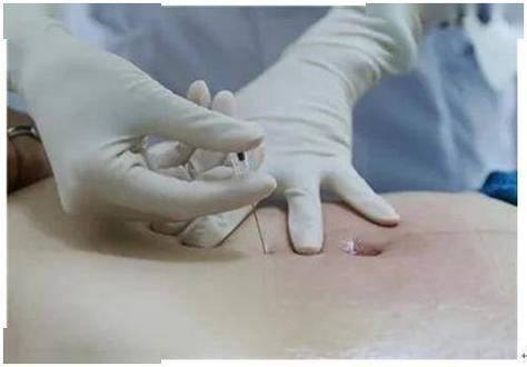 义乌柠栎整形美容门诊部特色项目及技术优势