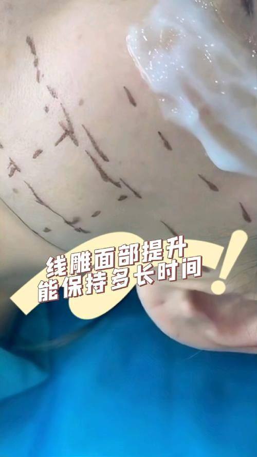 义乌柠栎整形美容门诊部是正规医院吗？