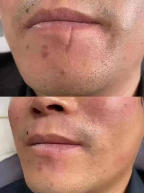 南京东部战区总医院特色项目及技术优势