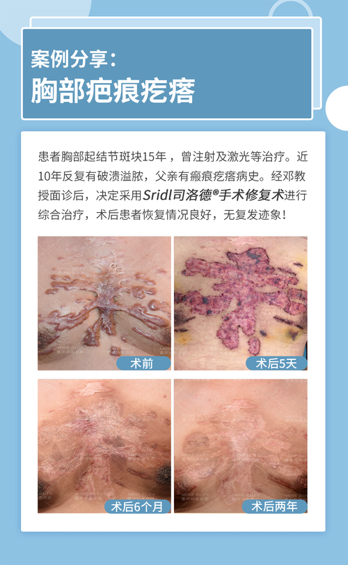 南京东部战区总医院详细的预约挂号方式及流程