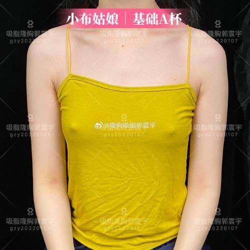 南京杏仁医疗美容门诊部真人口碑评价怎么样？