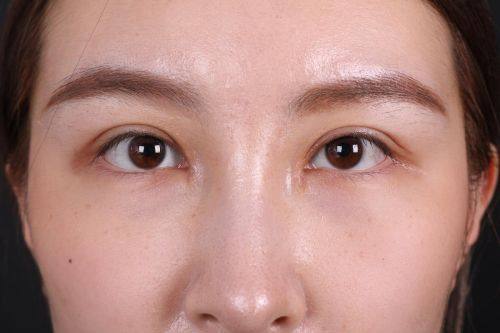 义乌柠栎整形美容门诊部真人口碑评价怎么样？