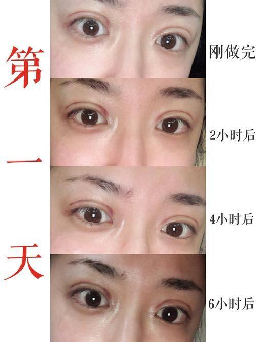 永州博美医疗美容医院真人口碑评价怎么样？