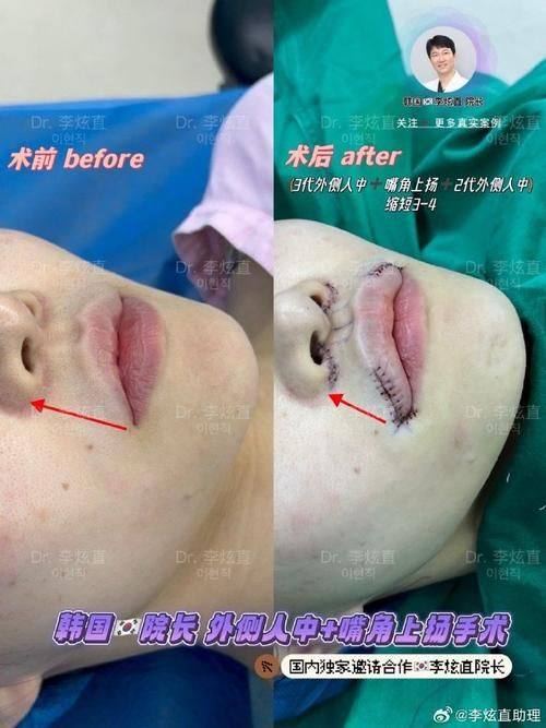 上海复大医院整形（皮肤科）详细的预约挂号方式及流程