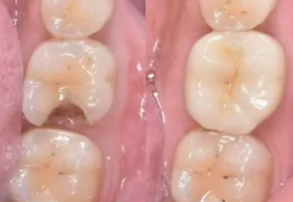 吉林壹舟健康口腔特色项目及技术优势