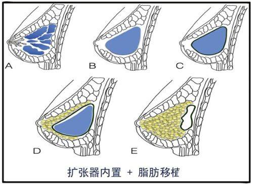 河南南阳惠康皮肤医院真人口碑评价怎么样？