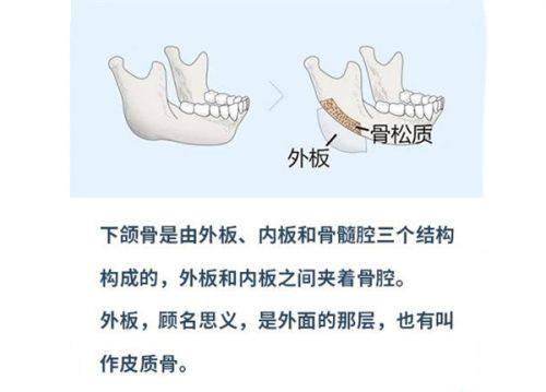 河南南阳惠康皮肤医院是正规医院吗？