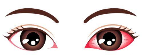 重庆好儿瞳视力简介概述