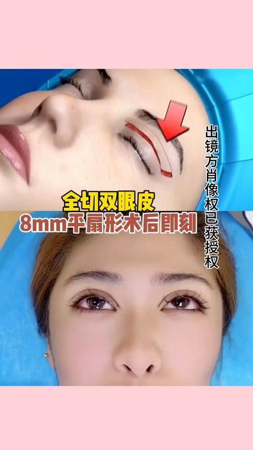 汕头伊丽莎白整形医院特色项目及技术优势