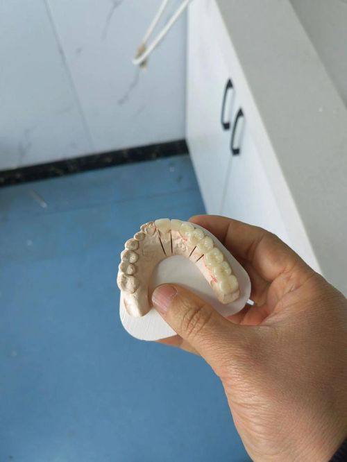 南京杜瑶口腔详细的预约挂号方式及流程