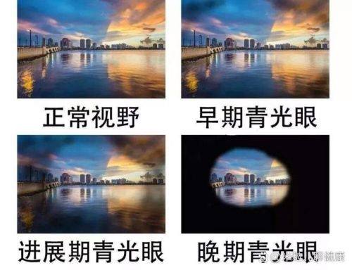 黄冈市中医医院眼科地址电话营业时间