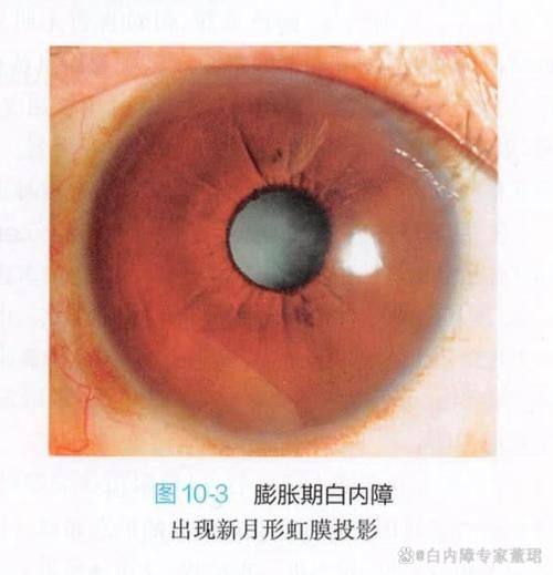 贵港华厦眼科医院收费价格表/收费标准