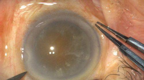 贵港华厦眼科医院地址电话营业时间