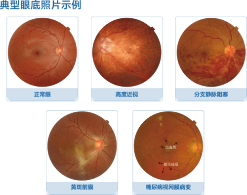 深圳多视点眼科门诊部收费价格表/收费标准