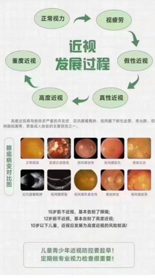 西安市高陵区妇幼保健院眼科详细的预约挂号方式及流程
