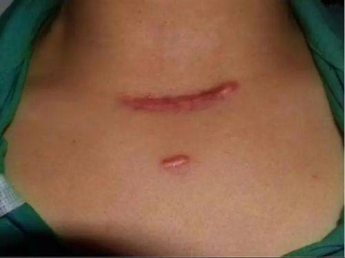 海口肤康皮肤病医院地址电话营业时间