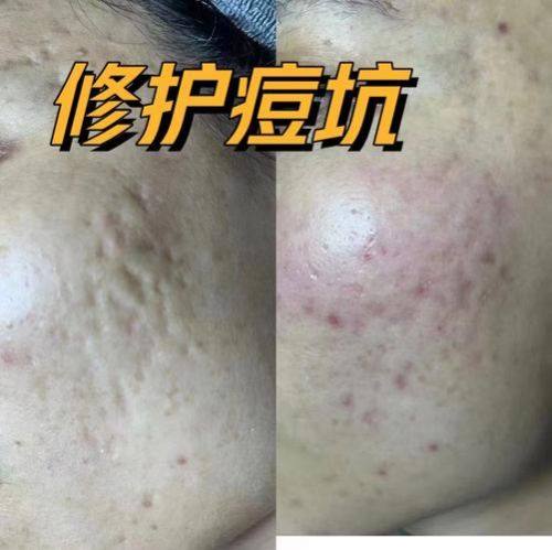 海口肤康皮肤病医院收费价格表/收费标准