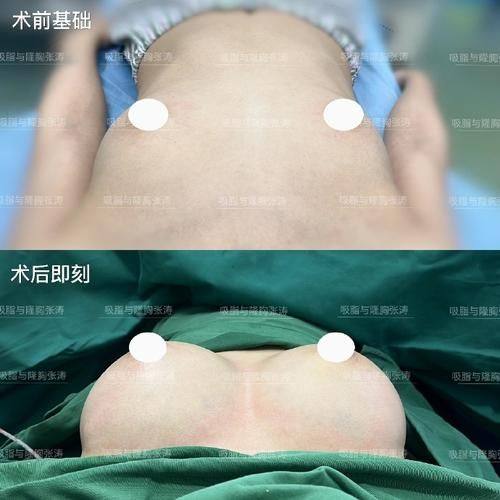 海南海口星颜悦色整形医院收费价格表