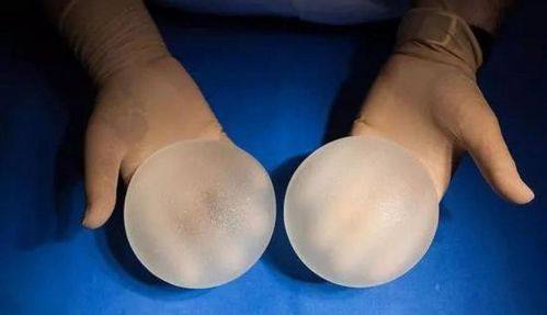 海南海口星颜悦色整形医院是正规医院吗？