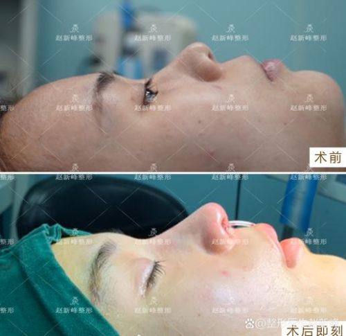 北京大兴呈美整形医疗美容诊所收费价格表/收费标准