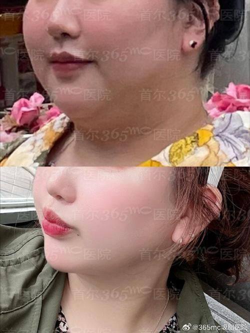 成都玛丽亚医疗美容整形医院是正规医院吗？