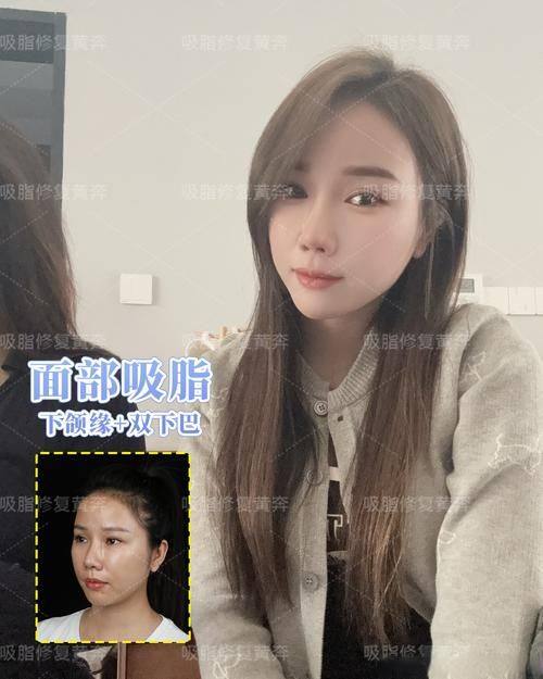 成都玛丽亚医疗美容整形医院真人口碑评价怎么样？