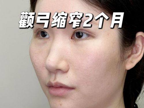 汕头伊丽莎白整形医院收费价格表/收费标准