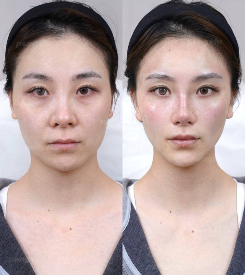 口碑评价及真人实例