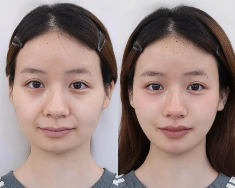 胡以信医生价格表