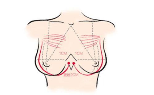 宿迁天黛整形医疗美容收费价格表/收费标准