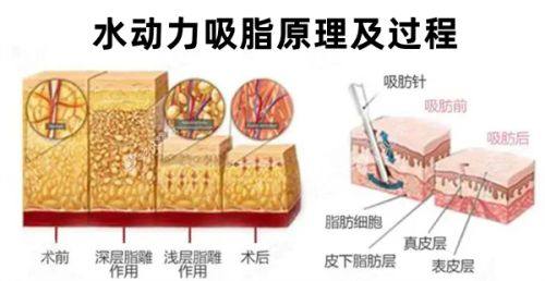 崔磊医生技术优势