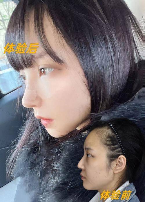 福州星悦医疗美容门诊部真人口碑评价怎么样？