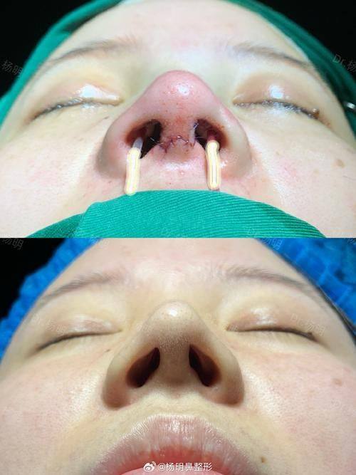 福州星悦医疗美容门诊部是正规医院吗？