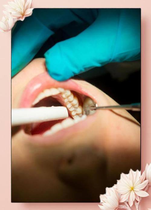 哈尔滨大象口腔门诊部收费价格表/收费标准