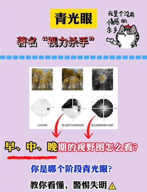 天津市第四中 心医院眼科是正规医院吗?