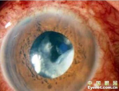 云浮市人民医院眼科医生团队实力