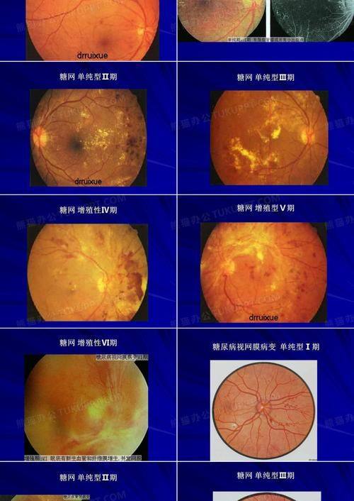厦门市第三医院眼科简介概述