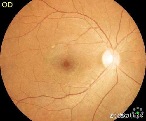 广州市红十字会医院眼科详细的预约挂号方式及流程