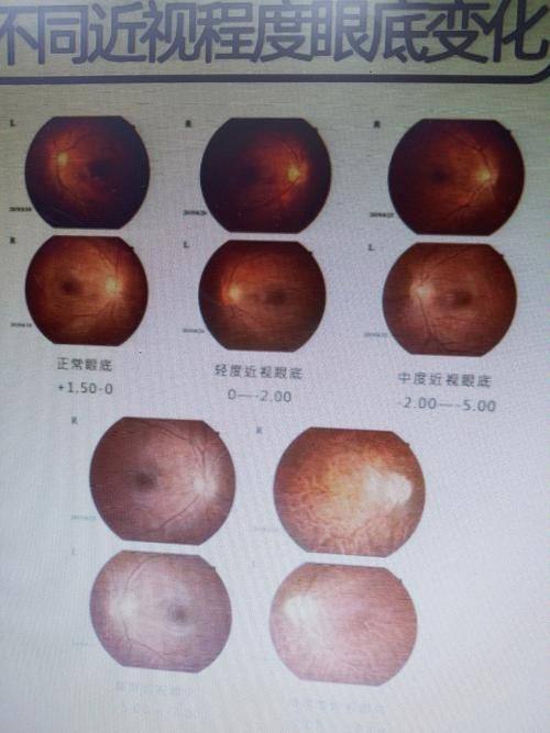 厦门市第三医院眼科收费价格表/收费标准