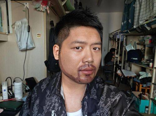 煕朵医疗美容植发连锁济南院部详细的预约挂号方式及流程