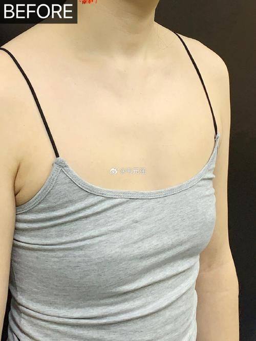 宿迁天黛整形医疗美容详细的预约挂号方式及流程