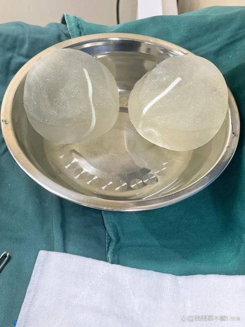 宿迁天黛整形医疗美容真人口碑评价怎么样？