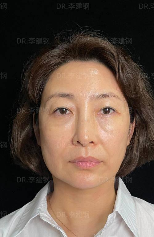 昆明同仁医院医疗美容科收费价格表/收费标准