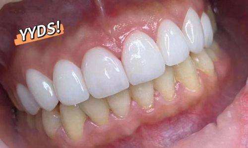 哈尔滨大象口腔门诊部详细的预约挂号方式及流程