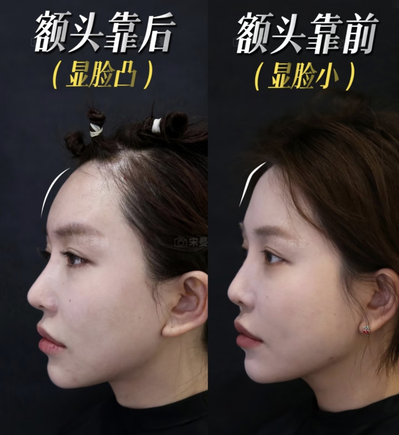 崔磊医生擅长项目