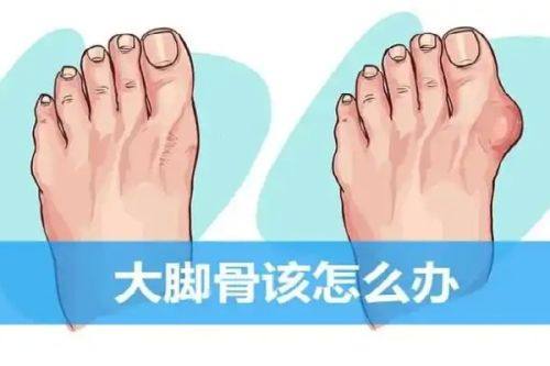 马子君医生技术优势