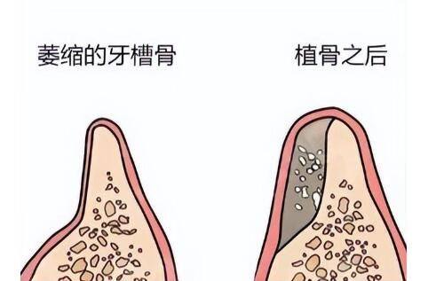 马子君医生擅长项目