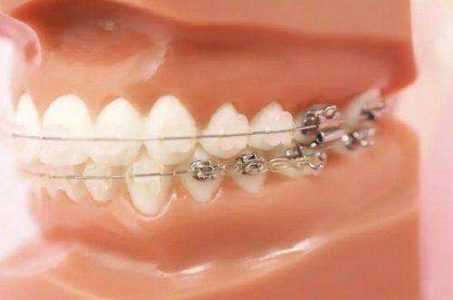 宁波海曙西门惠博口腔门诊部收费价格表/收费标准